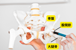 腸腰筋腱炎の写真